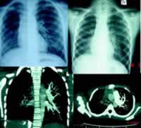 ��Ͽ�Ѫ2��