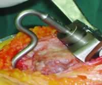 С�п��˹�ȫϥ�ؽ��û�����̽