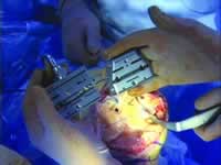 С�п��˹�ȫϥ�ؽ��û�����̽