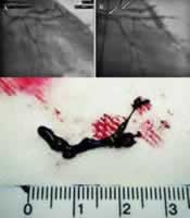 һ���µĸ�ֱ�ӵĹ�״����˨�ӡ��г�����