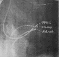 ϣ������ϣ�����Ժ������Ҽ�����𲫵�Ӧ��