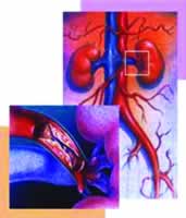 ��Ѫ���Ը�Ѫѹ�����ڽ�������