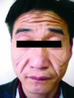 21������δ����˥Ƥ���ɳ�֢�ǻ���