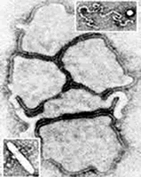 ����ƫ�β����ڶ�ͯ�кܳ���