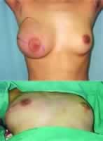 ���������鷿����ȱ����޸�