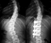 �������ط��Լ�����͹PUMC(Э��)����