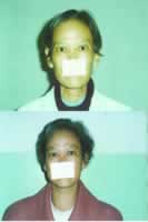 131I�Ƿ����������Ƽ׿��ϲ�����?