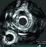 Ѫ���ڳ������о����̡���״�뷢չǰ��