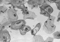 ��ȫ��Ч�Ŀ�-HPV�����Ԥ������������ϣ��