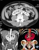 ���¼��ںϻ��κϲ�����ʯ