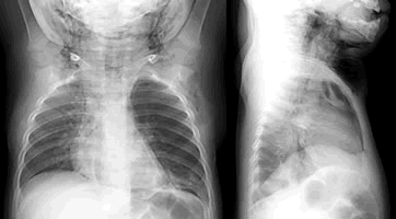 ֧�������ﲢ�ݸ���Ƥ�»���