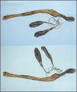 ��������ů��׳�����澫���裩