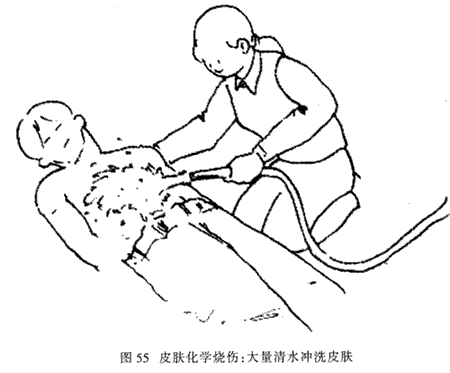 Ƥ����ѧ���˵ļ��Ȼ���(ͼ)