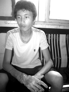 ����΢�����ߵļ��ȴ�ʩ(ͼ)