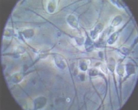 ��Щ�����뾫Һ�쳣�й�(ͼ)