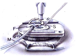 ����������ϸ����