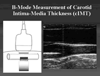 2�������� ������IMT��������