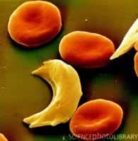 ѪҺ����Ԥ����״ϸ��ƶѪ������Σ��