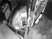 ��Ĥ���Ͳ�Ӱ�����������û���Զ��������