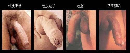 һ�����Ƥ��