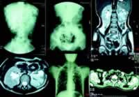 �������ѡ�ŧѪ�������ܲ�ȫ