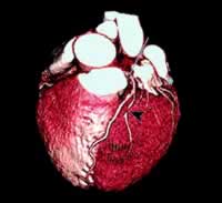 16��CT��Ϲ�����խ�о�����