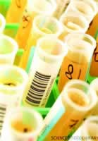 ��Ѫ�ܼ�����Ӧ���������