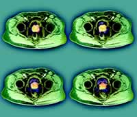 ǰ���ٰ�ҩ��ȥ������