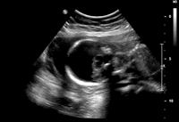 ̥��Ⱦɫ���쳣�ĳ������