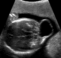 �������̥��������ϵͳ�쳣