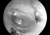 ����ͼ�ɸ������Ӥ�׶��ж���Һ