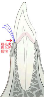 ���ѡ����ʹ�ú�ά����ˢ 