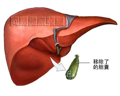 �����г���ͼ��