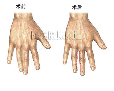 ��ָ�޸���