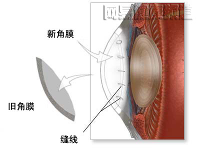 ��Ĥ��ֲ��