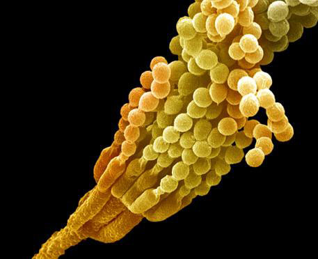 ��ù�أ�����ϸ������Ⱦ������