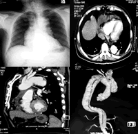 ���ȡ���ʹ����������