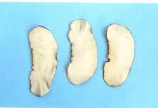 Umbellate Pore-Fungus