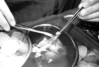 ������������ֲ�����󲢷�֢��Ӱ����ֲ��ת��