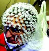 ��������Ч��Ԥ�и�ҩǰ�Ե�ͼ�����