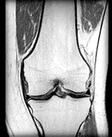 ���������ƹ��Թؽ�����Ч�������ò��ݺ���