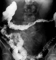 Ӣ���������������ƴ�ͳ�Ʒ�ʧ�ܵ������Խ᳦��