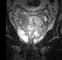 ֱ������Ȧ������3.0 T�Ź���ǰ���ټ��