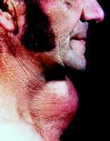 Graves���׿���������¹۵�