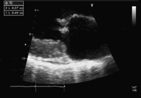 �ļ��������Գ�Ѫ