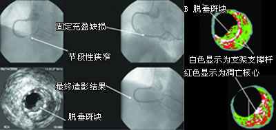 ����֧�����������ذ߿��Ѵ�