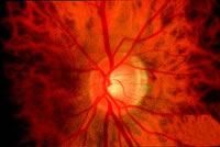 ��TNF-�����������������