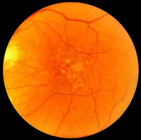 ������������Ԥ���ư߱���