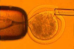 ��ѧͻ�ƣ����ÿ�¡��̥��ȡ��ϸ��