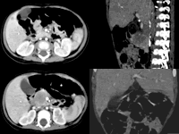 ��ͷ�����Ի�ɫ��ѿ��һ��